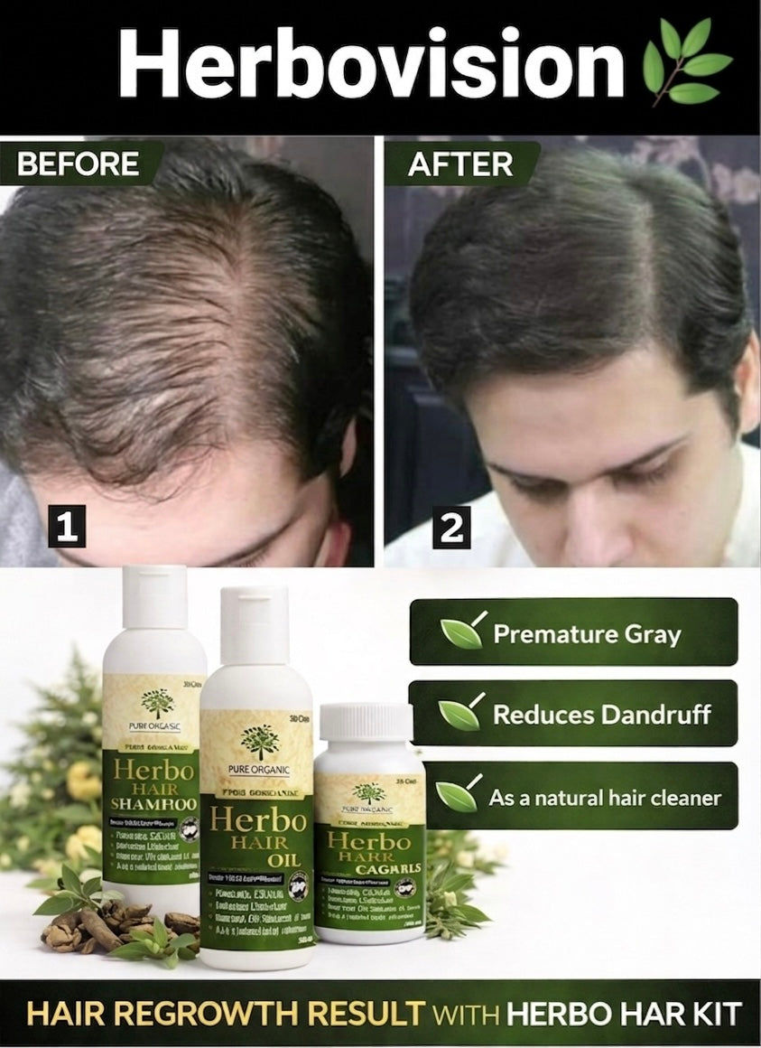 Complete Hair Regrowth Kit – Advanced Herbal Solution for Hair Fall & Hair Growth